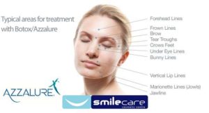 Anti-Wrinkle Injections Treatment - Azzalure Injections