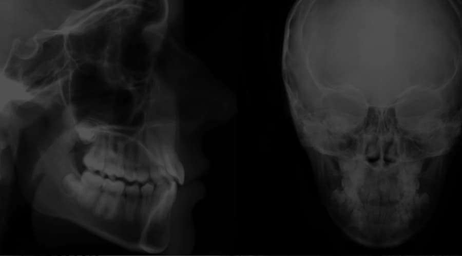 What is the centric relationship in dentistry and what is its function