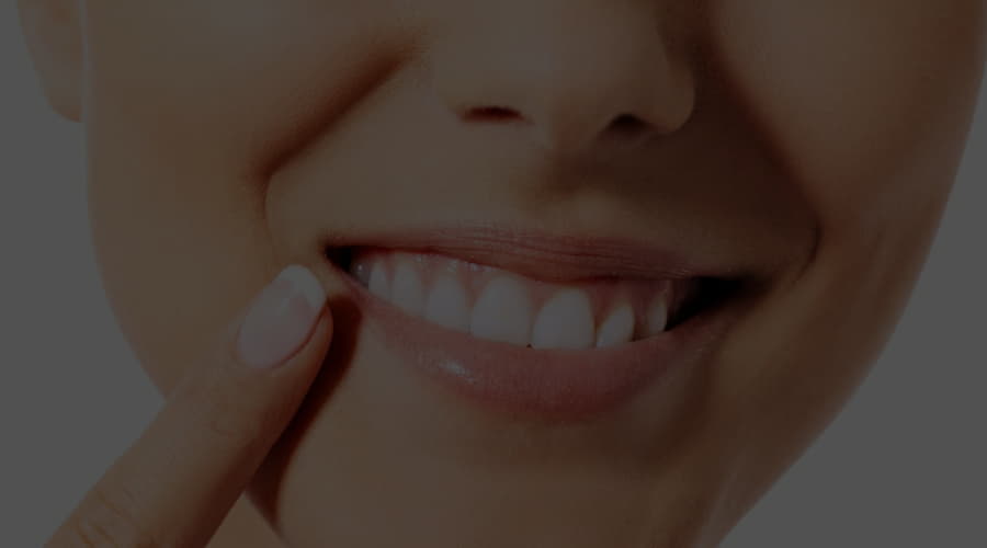 What is the interdental papilla and why is it important? Smile Care