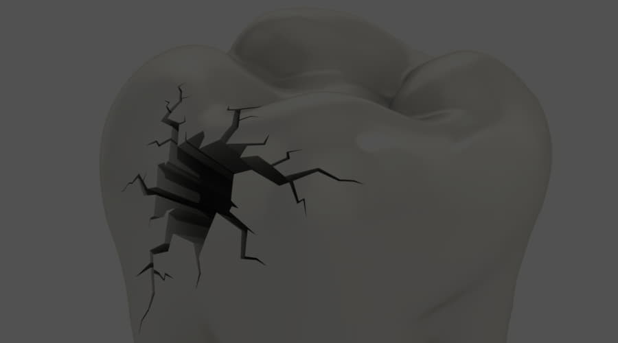 What is tooth decay and how can it be prevented? Smile Care