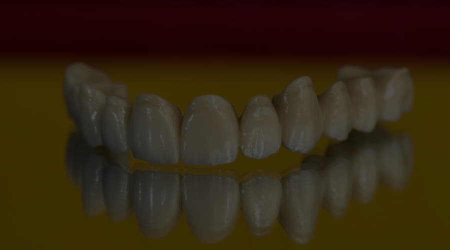 Zirconia dental bridges, what are they and when are they indicated